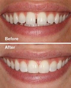 Cosmetic Dentistry in San Antonio Dr. Precious Thomson. Thousand Oaks Dental. General, Cosmetic, Restorative, Preventative, Pediatric, Family Dentistry. Dentist in San Antonio Texas 78232