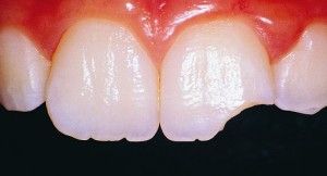 Emergency Dentist in San Antonio, TX Dr. Precious Thomson. Thousand Oaks Dental. General, Cosmetic, Restorative, Preventative, Pediatric, Family Dentistry. Dentist in San Antonio Texas 78232