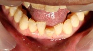 Emergency Dentist in San Antonio, TX Dr. Precious Thomson. Thousand Oaks Dental. General, Cosmetic, Restorative, Preventative, Pediatric, Family Dentistry. Dentist in San Antonio Texas 78232