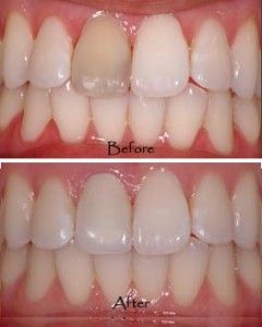 Cosmetic Dentistry in San Antonio Dr. Precious Thomson. Thousand Oaks Dental. General, Cosmetic, Restorative, Preventative, Pediatric, Family Dentistry. Dentist in San Antonio Texas 78232