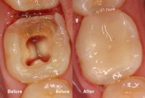 General Dentistry Dr. Precious Thomson. Thousand Oaks Dental. General, Cosmetic, Restorative, Preventative, Pediatric, Family Dentistry. Dentist in San Antonio Texas 78232
