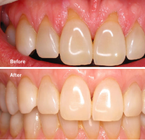 Periodontal Care in San Antonio, TX Dr. Precious Thomson. Thousand Oaks Dental. General, Cosmetic, Restorative, Preventative, Pediatric, Family Dentistry. Dentist in San Antonio Texas 78232