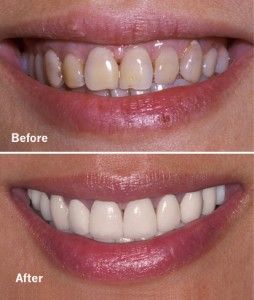Cosmetic Dentistry in San Antonio Dr. Precious Thomson. Thousand Oaks Dental. General, Cosmetic, Restorative, Preventative, Pediatric, Family Dentistry. Dentist in San Antonio Texas 78232