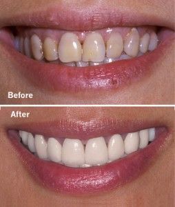 Cosmetic Dentistry in San Antonio Dr. Precious Thomson. Thousand Oaks Dental. General, Cosmetic, Restorative, Preventative, Pediatric, Family Dentistry. Dentist in San Antonio Texas 78232