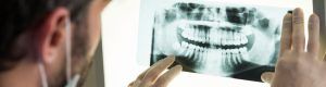 Orthodontics clear aligners braces in San Antonio thousand oaks dental dentist in san antonio