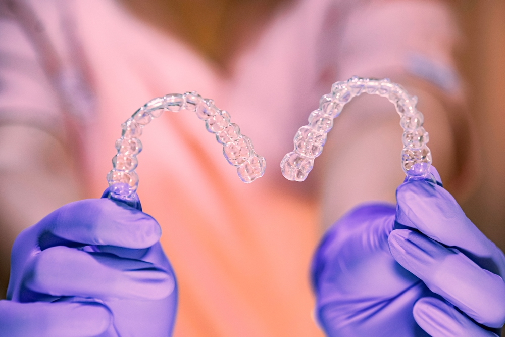 Clear Aligners in San Antonio